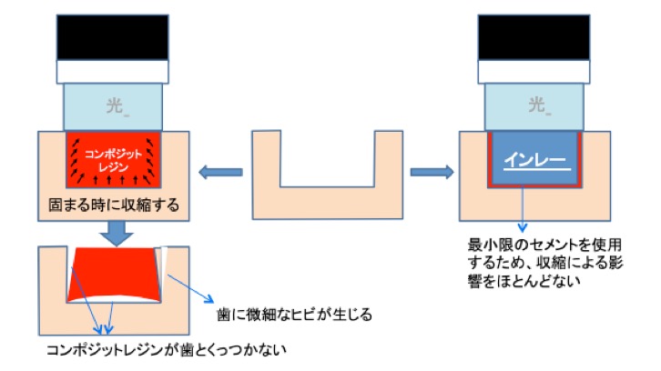 秋津・新秋津の歯医者 秋津歯科・矯正歯科
