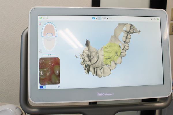 mousepiece orthodontics