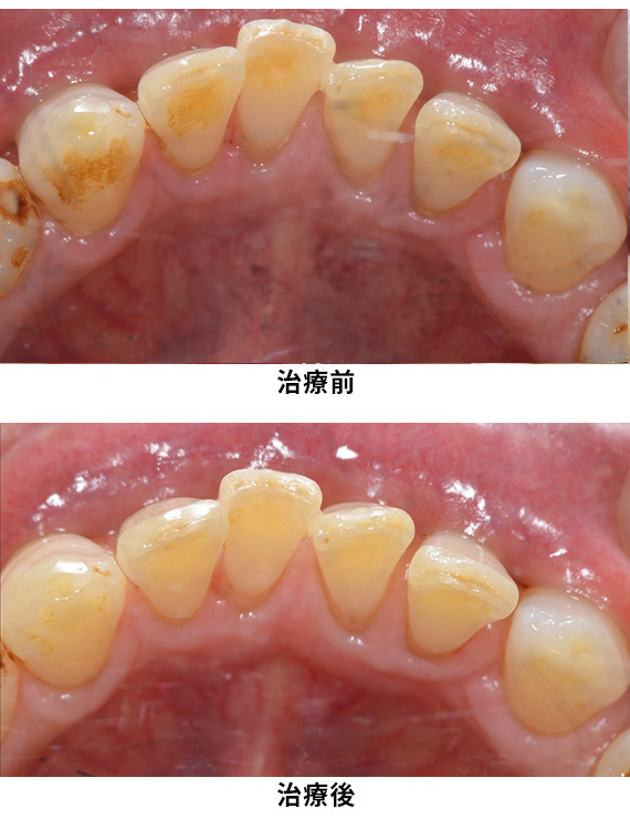 プロフェッショナルケア症例