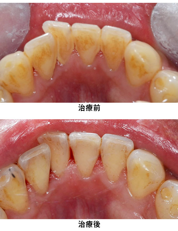 プロフェッショナルケア症例