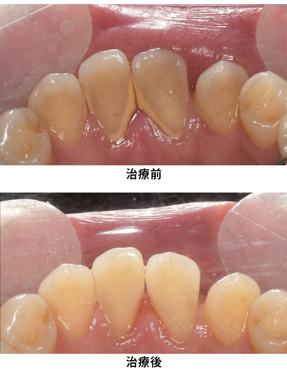 プロフェッショナルケア症例