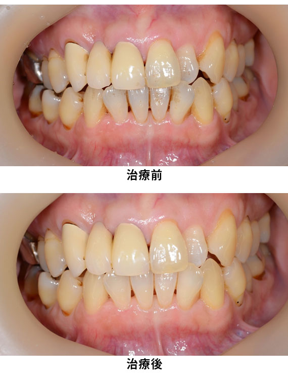 プロフェッショナルケア症例