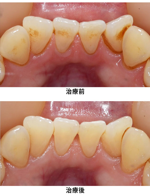 プロフェッショナルケア症例