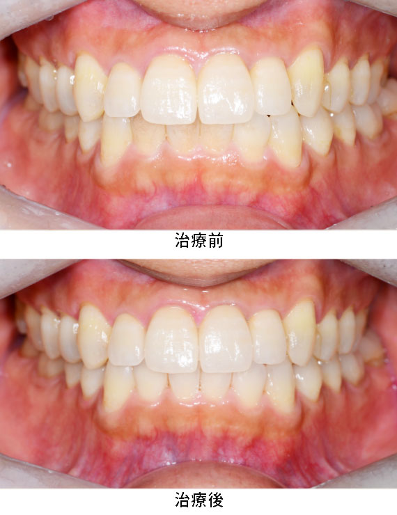 プロフェッショナルケア症例
