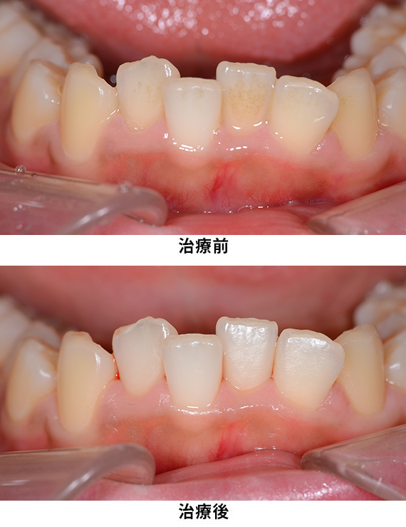プロフェッショナルケア症例