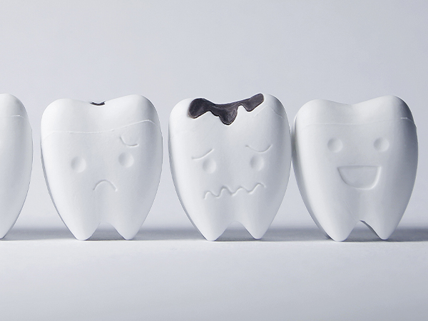 Caries prevention