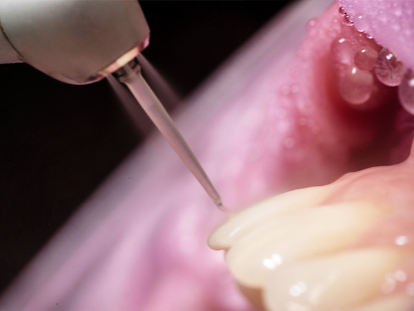 Caries prevention