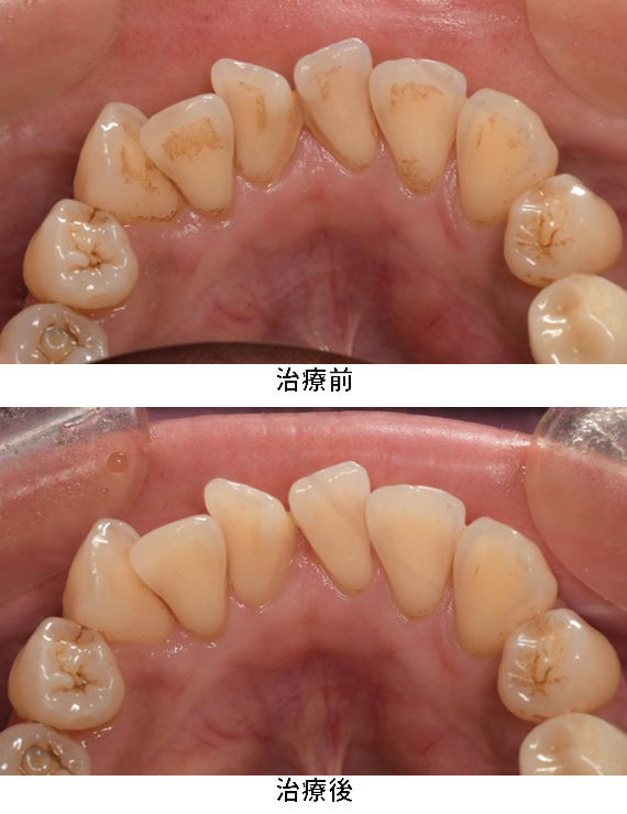 プロフェッショナルケア症例