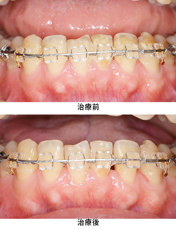 プロフェッショナルケア症例