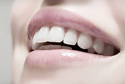 セラミックとホワイトニングの違いとは？