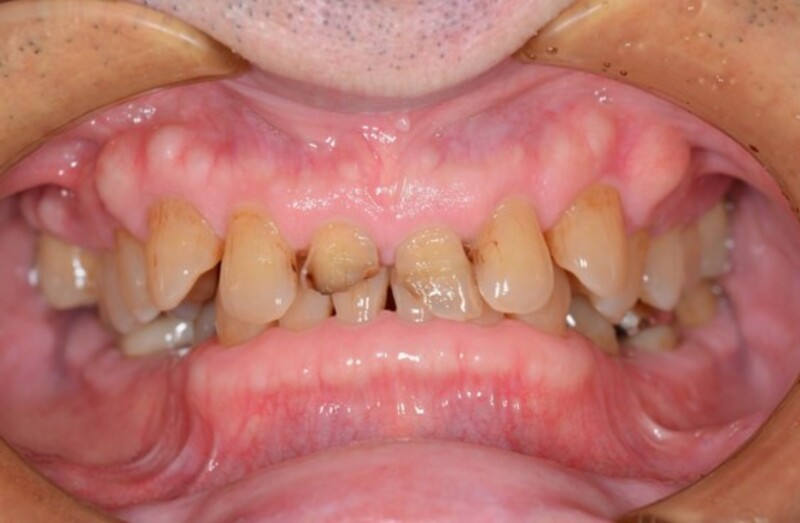 Before