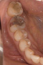 Before