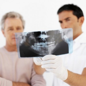Wisdom teeth after swelling and pain