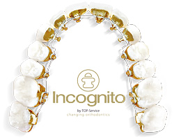 backside orthodontics