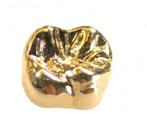 ceramic gold crown