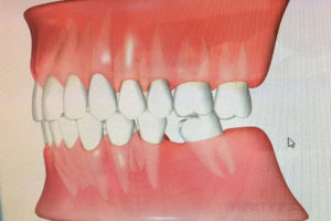 image1