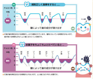 飲食のたびに歯がとける