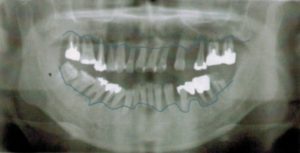 image6