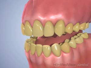 office whitening1