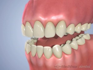 officewhitening2