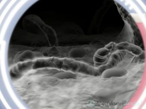 perio fungus