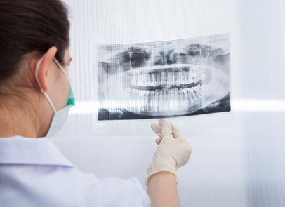 歯医者が教えるどこよりも詳しい歯の移植！